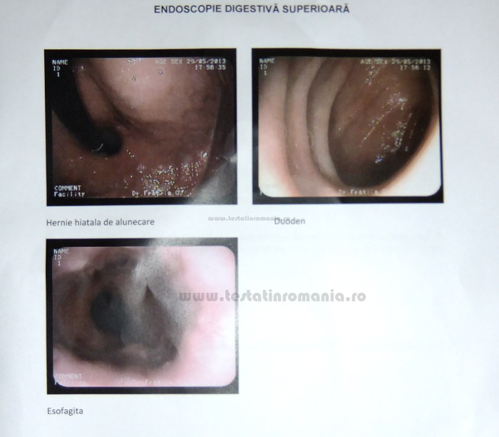 endoscopie poze