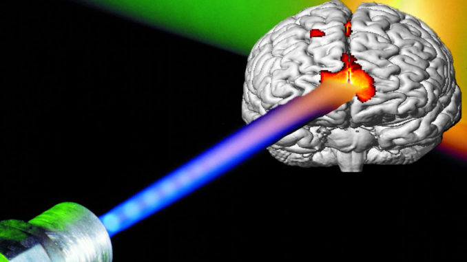 laser-brain