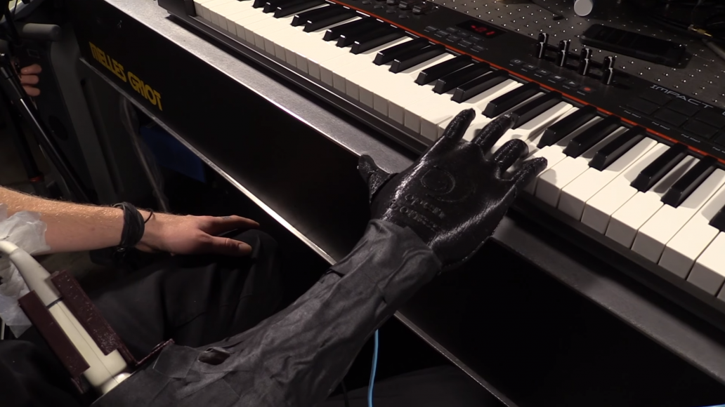 Un muzician utilizează cu succes o mâna artificială în locul celei amputate