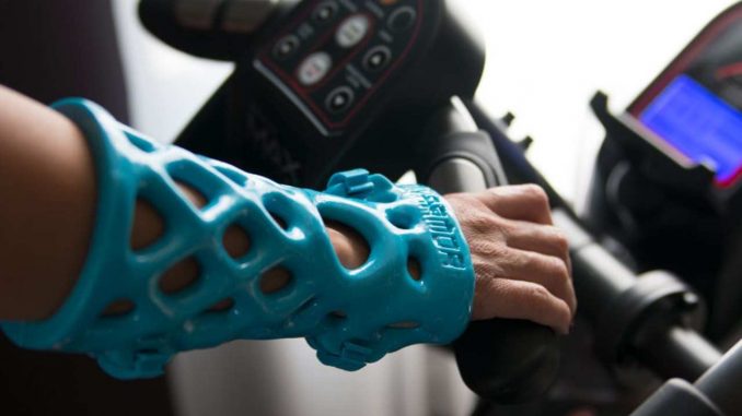a-3d-printed-cast-by-activarmor-activarmor-190211