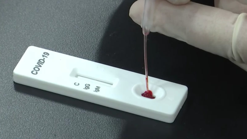 Oamenii de știință chinezi au dezvoltat un test rapid pentru coronavirus